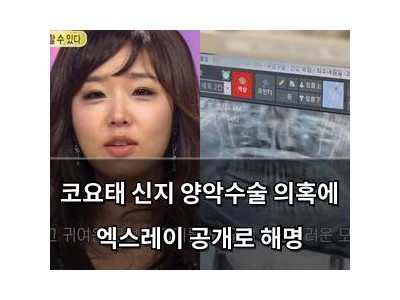 코요태 신지 양악수술 의혹에 엑스레이 공개로 해명